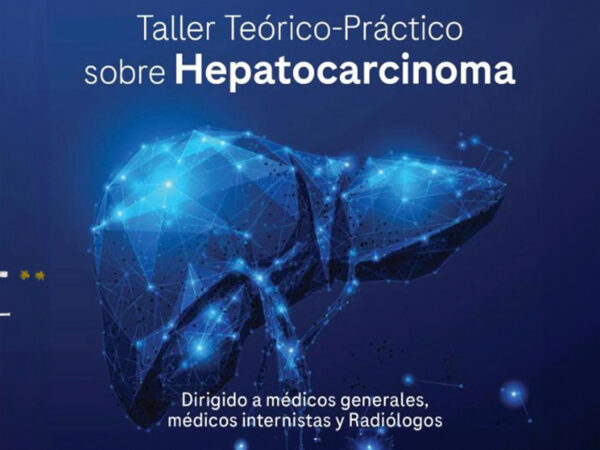 Taller Hepatocarcinoma